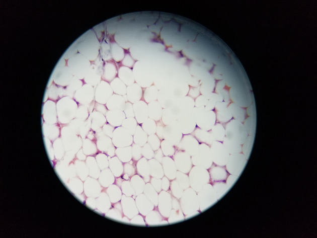 Adipose Connective Slides - Adipose Connective 03 400X